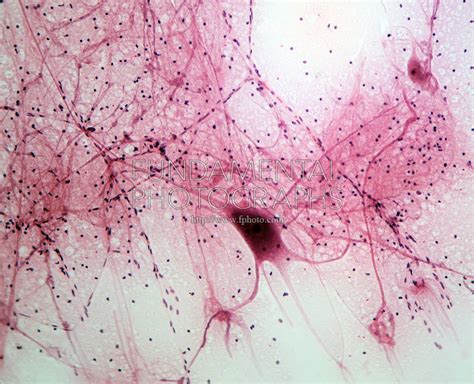 Neuron Microscope 400x