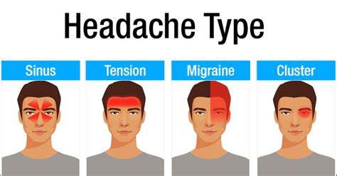 Headache Types Chart