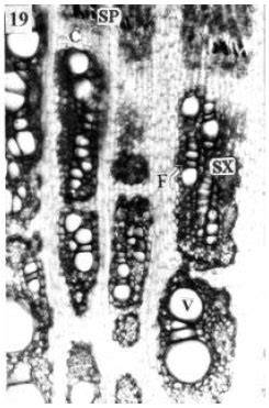 Anatomy of the Hypocotyl of Country Bean