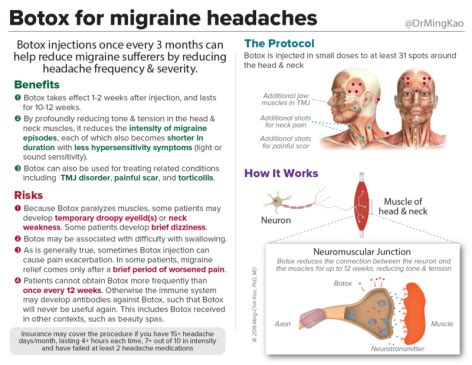 Botox for migraine headaches – Dr Ming Kao | Botox migraine, Chronic migraines, Migraine