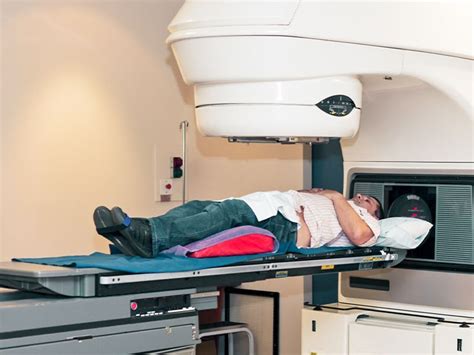 External Beam Radiation Therapy (EBRT): Purpose and Procedure