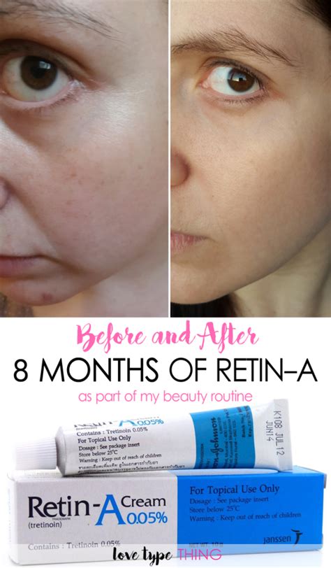 Before and After Retin-A - 8 months results | Skin care, Anti aging ...