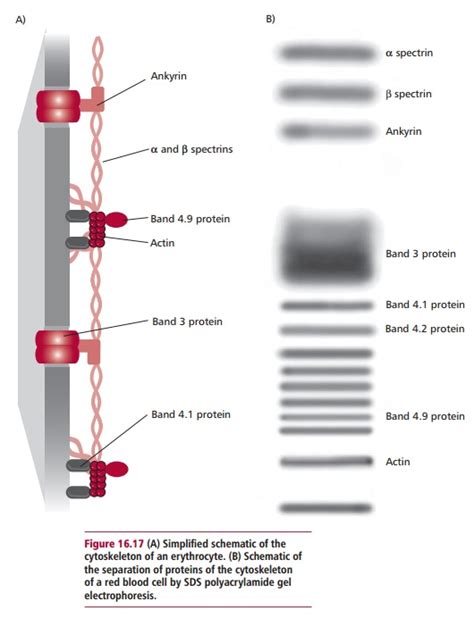 Hereditary Elliptocytosis and Spherocytosis: Diagnosis and treatment