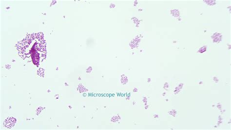 Microscope World Blog: Salmonella under the Microscope