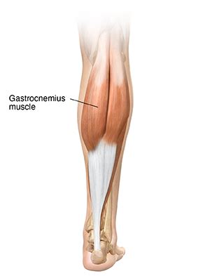 Understanding Gastrocnemius Muscle Tear | Saint Luke's Health System