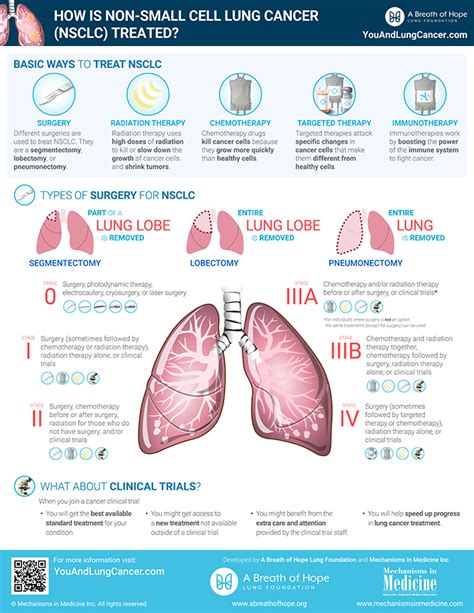 Infographics