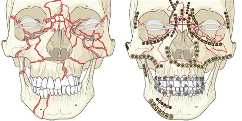 Trauma de Face - Salvador, BA | Dr. Adriano Assis