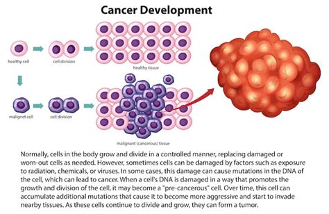 Free Vector | Cancer Development vector with information