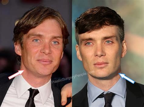 Cillian Murphy: BEFORE and AFTER 2022