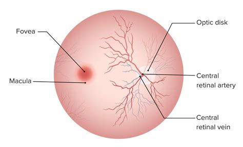 pacífico estanque miembro irrigacion del ojo Distinción tallarines Extinto