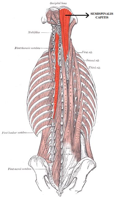 Semispinalis Capitis - Physiopedia