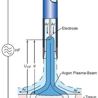 (PDF) Argon plasma coagulation