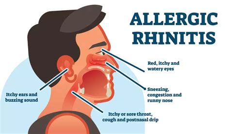 SELF-CARE TIPS TO MANAGE RHINITIS SYMPTOMS | Dr Batra’s®