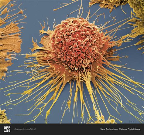 Activated human macrophage under a Color scanning electron micrograph. stock photo - OFFSET