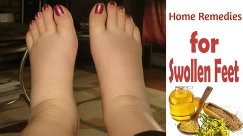 Top 5 Effective Home Remedies For Swollen Feet And Ankle Morpheme Remedies India – Otosection