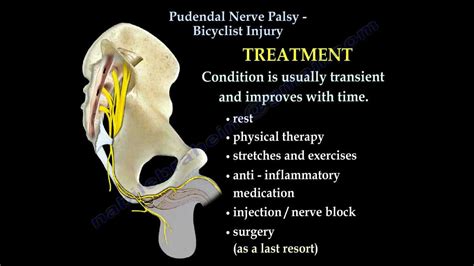 Pudendal Nerve Palsy Bicyclist Injury - Everything You Need To Know - Dr. Nabil Ebraheim - YouTube