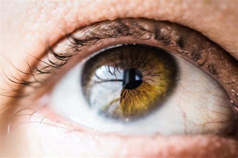 Home Remedies for Meibomian Gland Dysfunction – Dry Eye Therapy