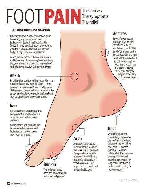 Types Of Foot Pain Diagram