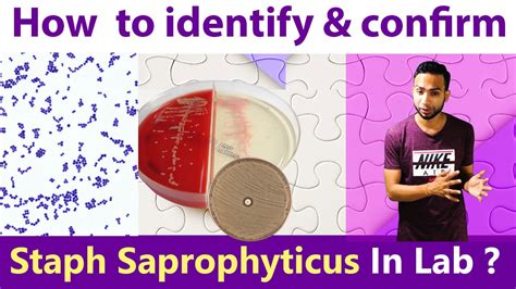 Staphylococcus Saprophyticus Colony Morphology