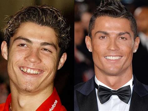 Antes y después: 15 famosos que afortunadamente se arreglaron los dientes