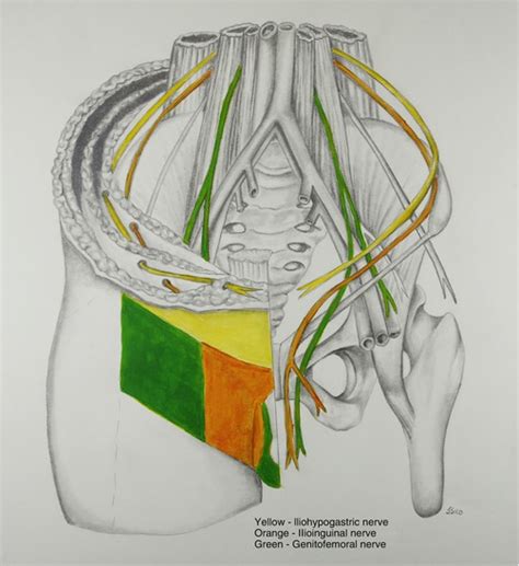 Inguinal Pathology | Musculoskeletal Key