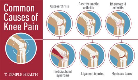 Do I Need Surgery If My Knee Hurts? | Temple Health