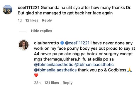 Claudine Barretto says she never underwent plastic surgery on face