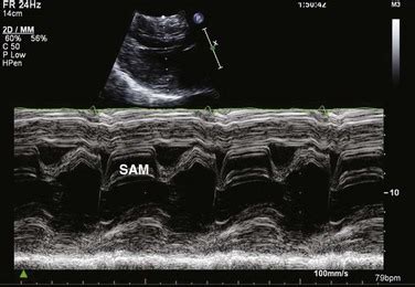 Echocardiography | Anesthesia Key