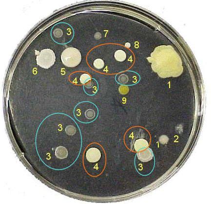 Image result for petri dish bacteria identification chart | Biomedical science, Microbiology ...