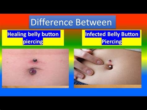 Distinction between Healing belly button piercing and Infected Belly Button Piercing - YouTube