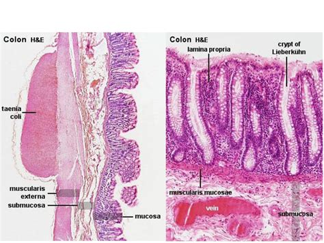 Taenia Coli Histology