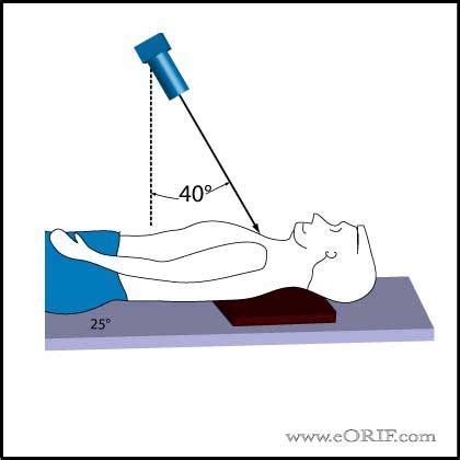 Serendipity View Shoulder Xray | X ray, Shoulder, Radiographer