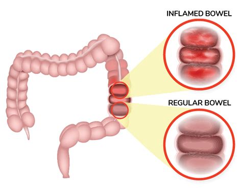 EPI And Other Digestive Diseases In Dogs - Dogs Naturally Magazine