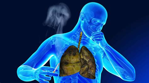 What’s Smoker’s Cough? Symptoms, Cure, Treatment Smoker’s Cough