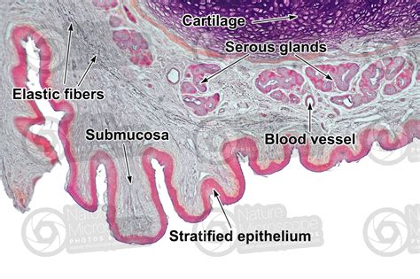 Larynx Histology Labeled