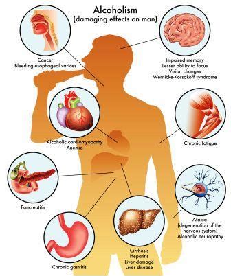 Alcohol Intoxication - Symptoms, Treatment As Per Ayurveda