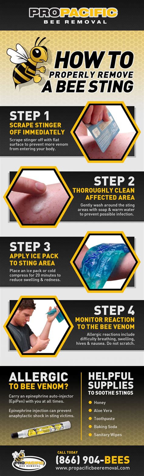 Properly Remove & Treat A Bee Sting Infographic Health Remedies, Home ...