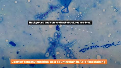 Loeffler Methylene Blue Stain: Introduction, Principle, Composition, Prepar