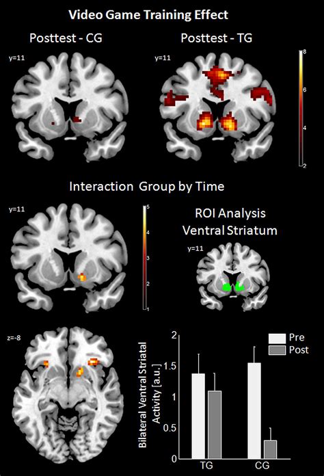 Frontiers | Video game training and the reward system | Frontiers in Human Neuroscience