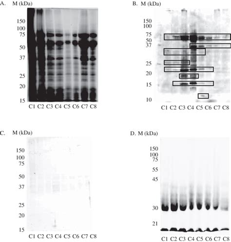 Reaction of allergy-specific human IgE to wheat on protein fraction. A,... | Download Scientific ...