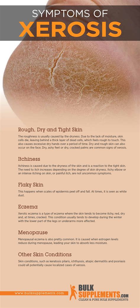 Xerosis (Dry Skin): Symptoms, Causes & Treatment