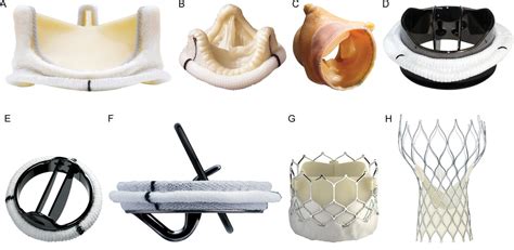 Prosthetic Heart Valves Are Generally Prepared From Bovine Tissues And ...