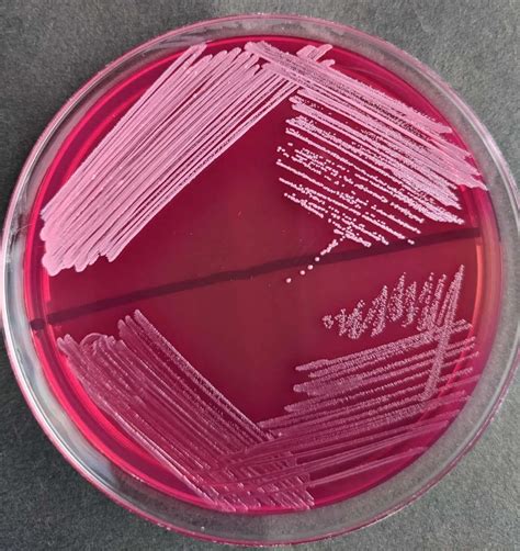 MacConkey Agar: Composition, Uses, Colony Characteristics