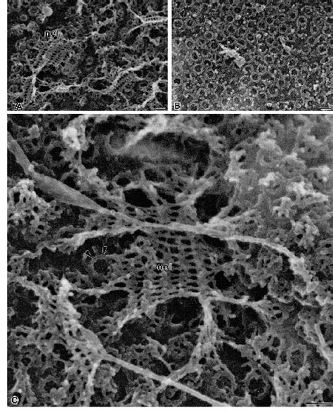 Figure 3 from The nuclear pore complex: three-dimensional surface structure revealed by field ...