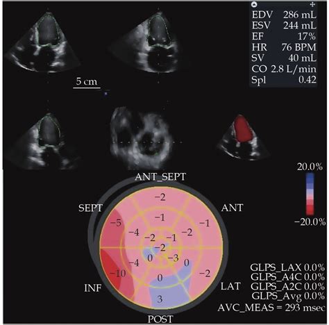 The baseline two-dimensional echocardiography and three-dimensional ...