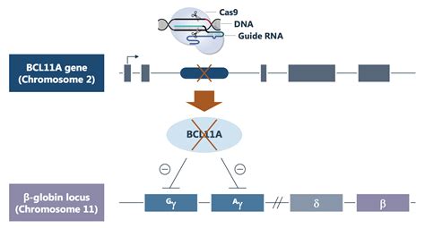 Cutting Edge Gene Therapies: Beta-Thalassemia Breakthroughs (Part I) | Seeking Alpha