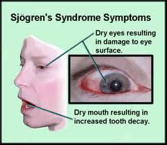 Sjogren's syndrome more common in women | Women's Health Research Institute