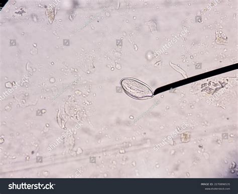 Pinworm Eggs Enterobius Vermicularis Scotch Tape Stock Photo 2270896535 | Shutterstock