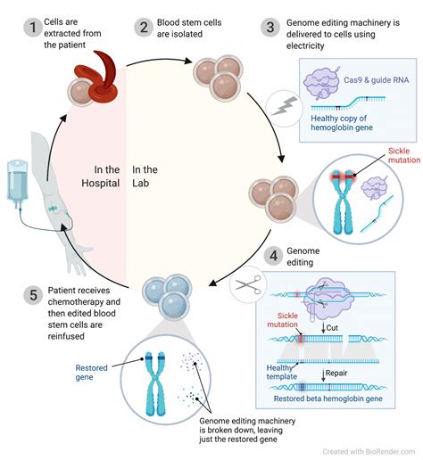 Discovery and development of a CRISPR-based therapy for sickle cell ...