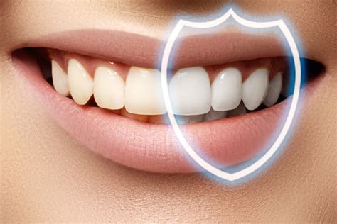 What is a Dental Bonding? | EDP Dental